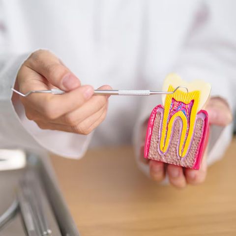 Root Canal Guide: Procedure Steps and Oral Health Basics