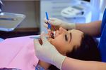 Dental Implants Guide: Process, Recovery Time, and Long-Term Care
